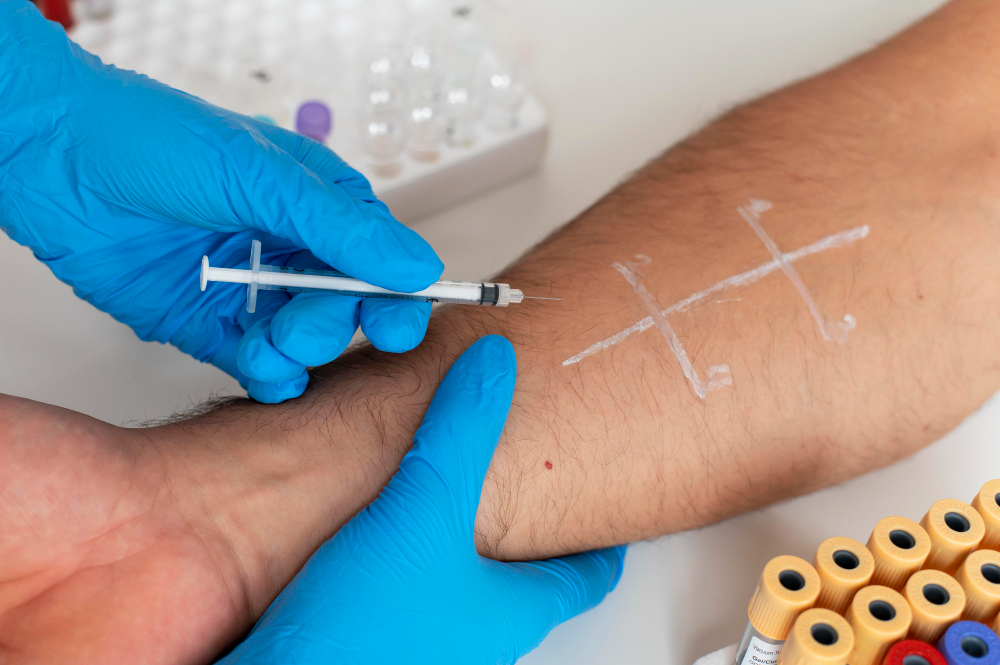 Minimally invasive varicose and spider vein treatments improving circulation and leg appearance