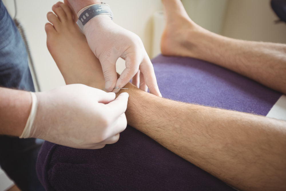 Common vein conditions related to spider veins and circulation problems