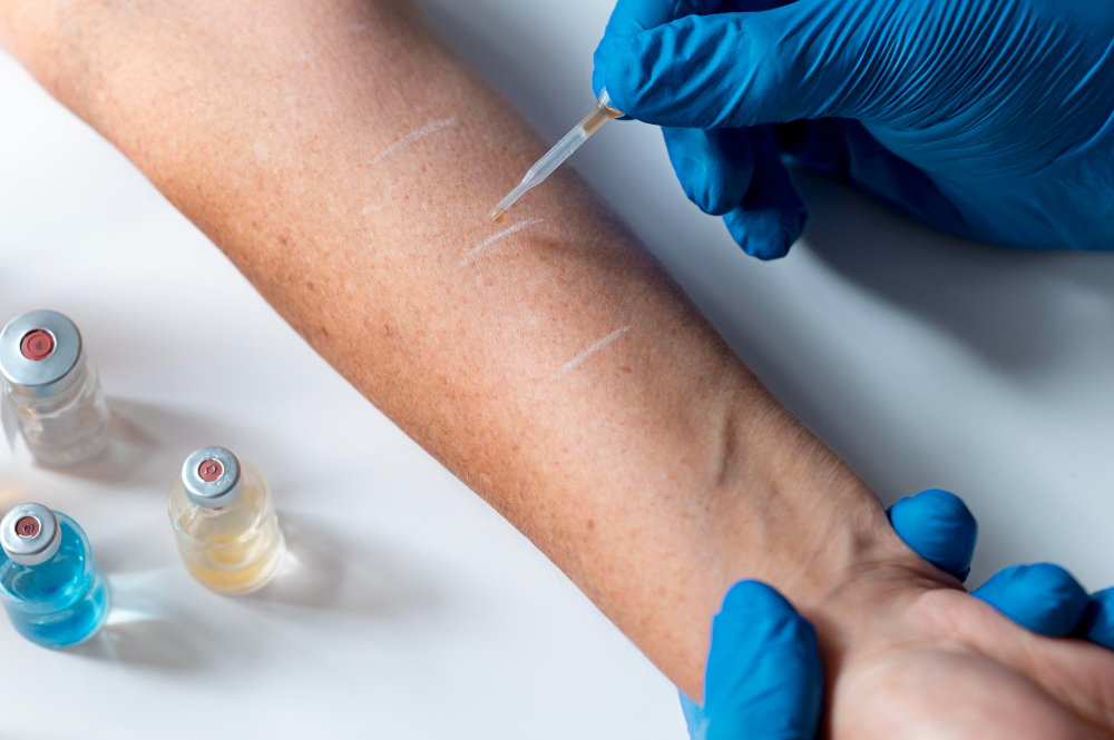 Visible spider veins on legs caused by circulation and vein issues