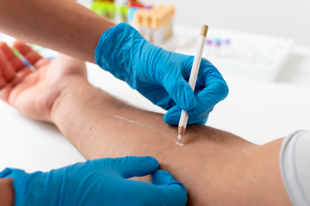 Non-surgical spider vein removal treatments including sclerotherapy and laser therapy